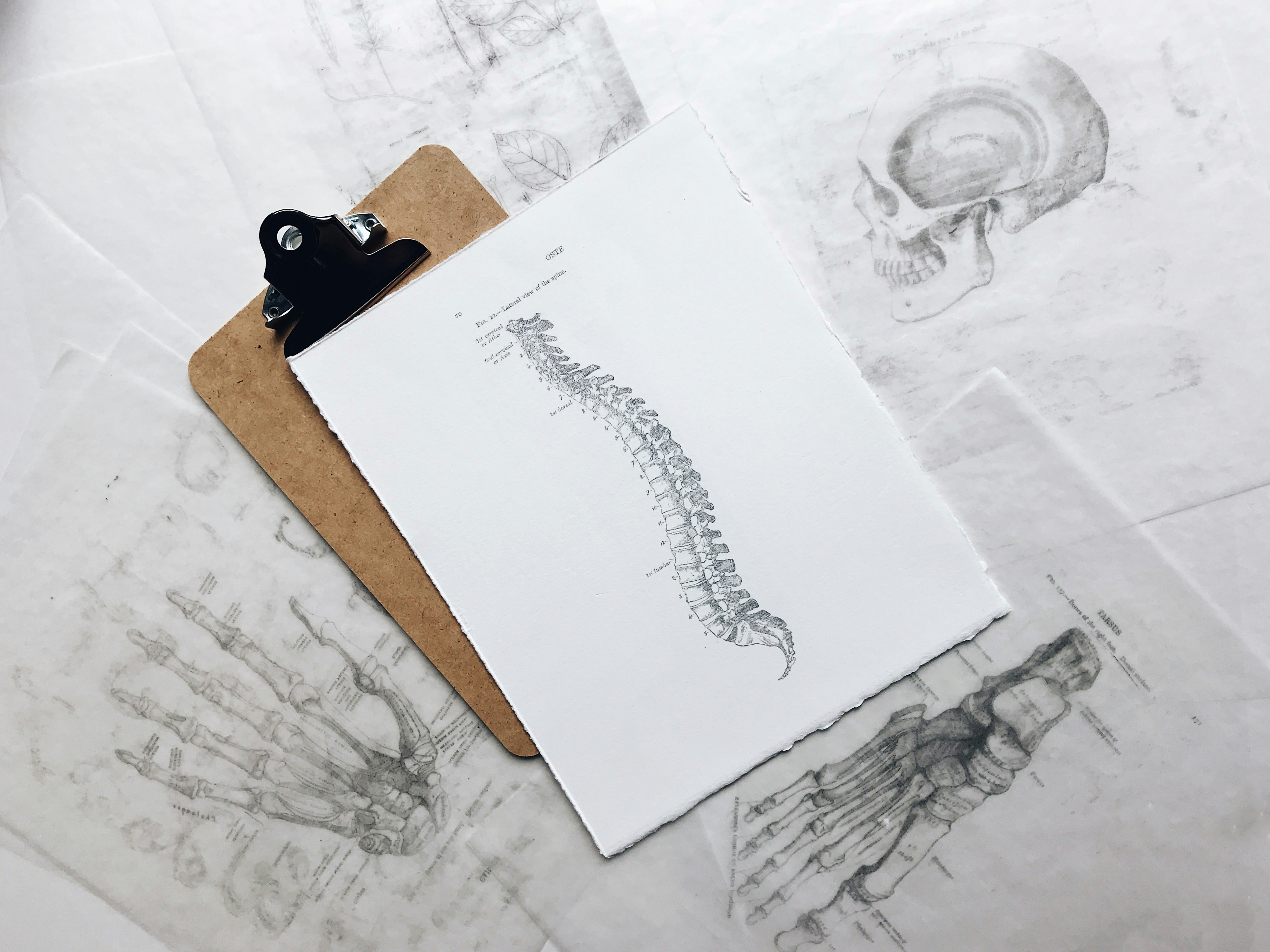 Image of spine on clipboard